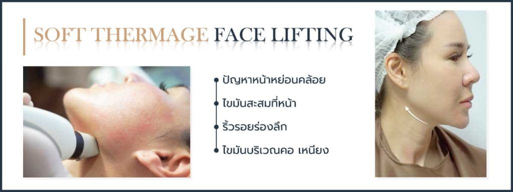 SOFT THERMAGE FACE LIFTING